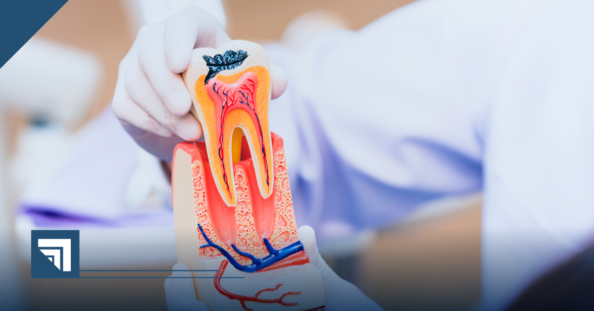 Universidad Cuauhtémoc Querétaro Diplomado en Endodoncia