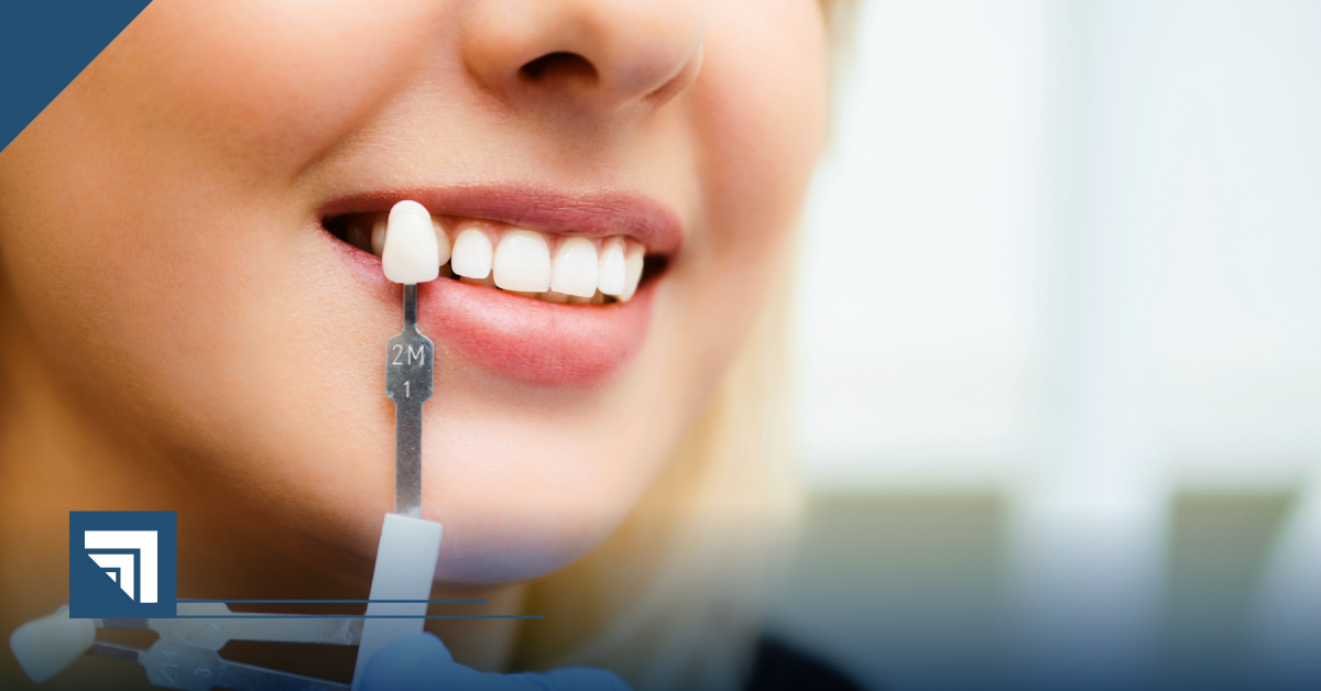 Universidad Cuauhtémoc Querétaro Diplomado en Estética Odontológica